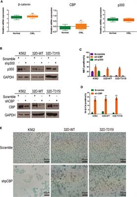 Target Inhibition of CBP Induced Cell Senescence in BCR-ABL- T315I Mutant Chronic Myeloid Leukemia